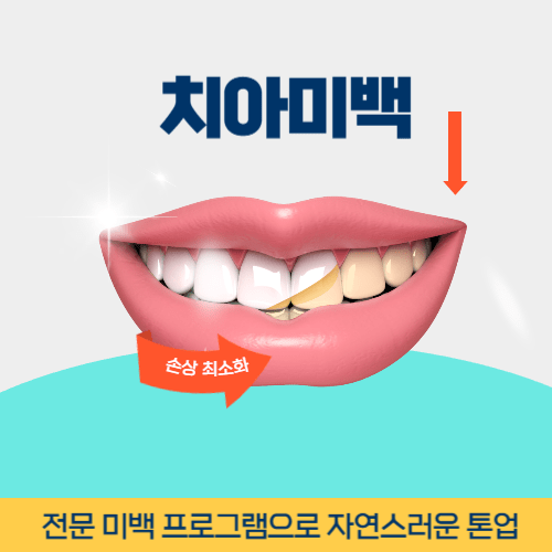 포천치과 포천시 치과 치아미백